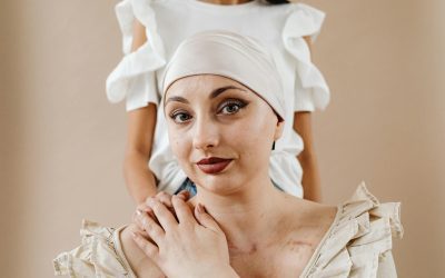 The Complete Guide to Benefits of Aloe Vera for Radiotherapy: Evidence-Based Solutions for Skin Care